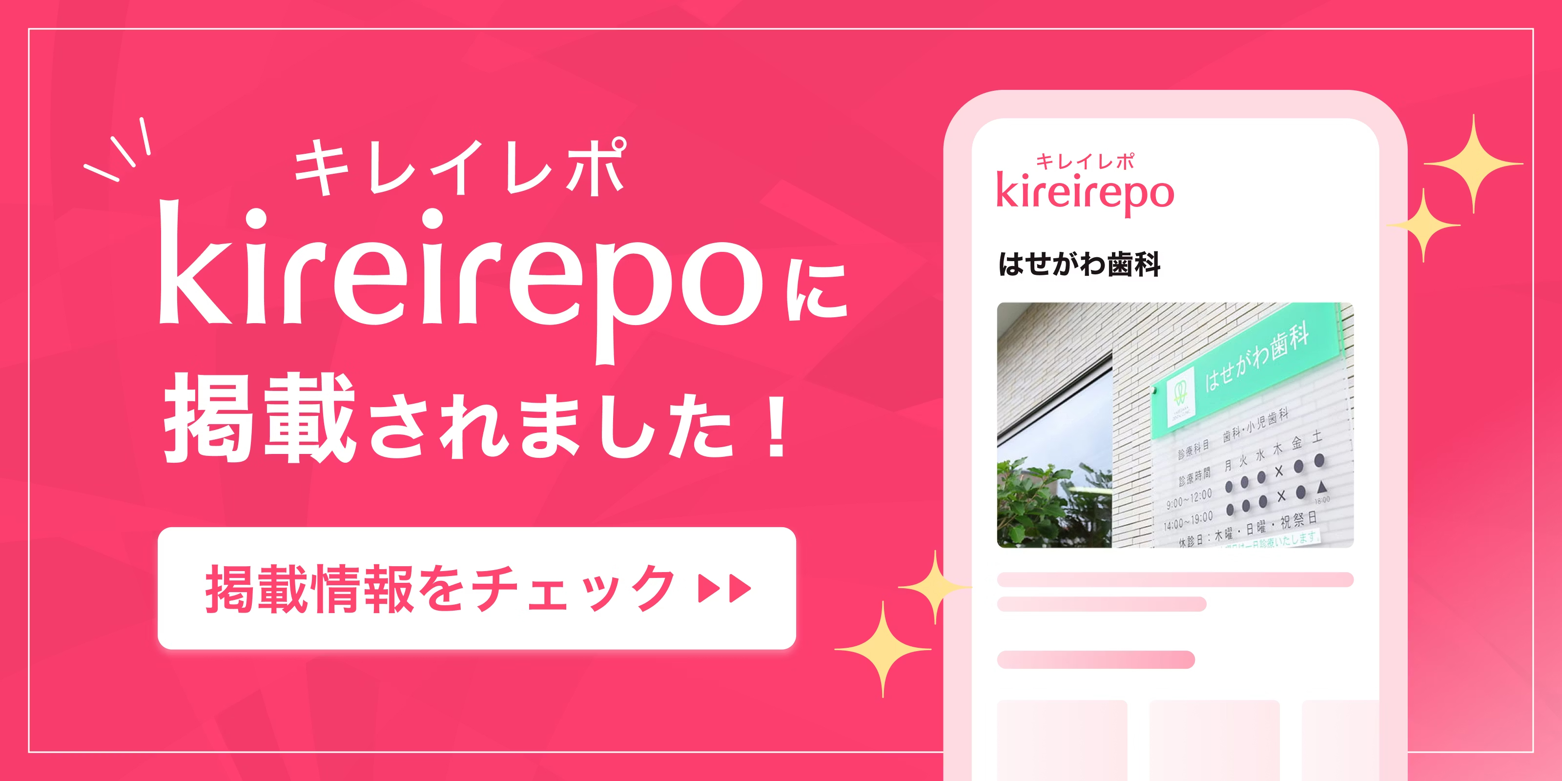 美容医療(自由診療・審美歯科)のプラットフォーム「キレイレポ」に「マウスピース矯正「DPEARL（ディパール）」について」の記事が掲載されました。